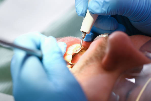 Best Emergency Treatment for Oral Infections in Storrs, CT