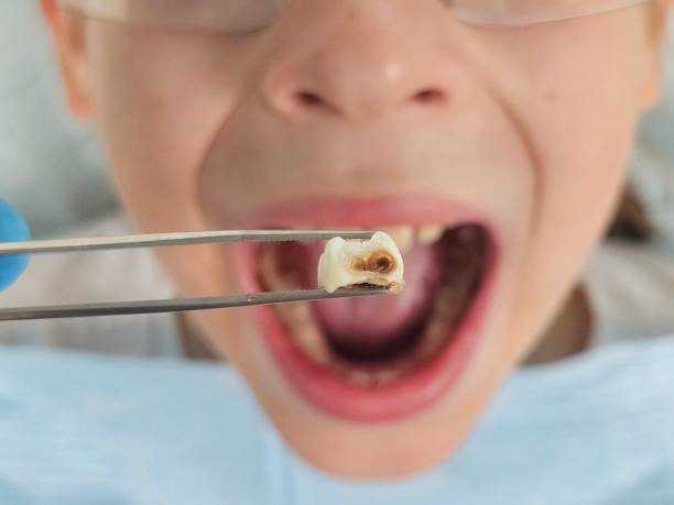 Professional Emergency Dental Service in CT